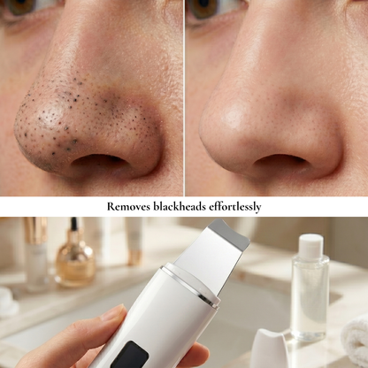 Ultrasonic Skin Scrubber