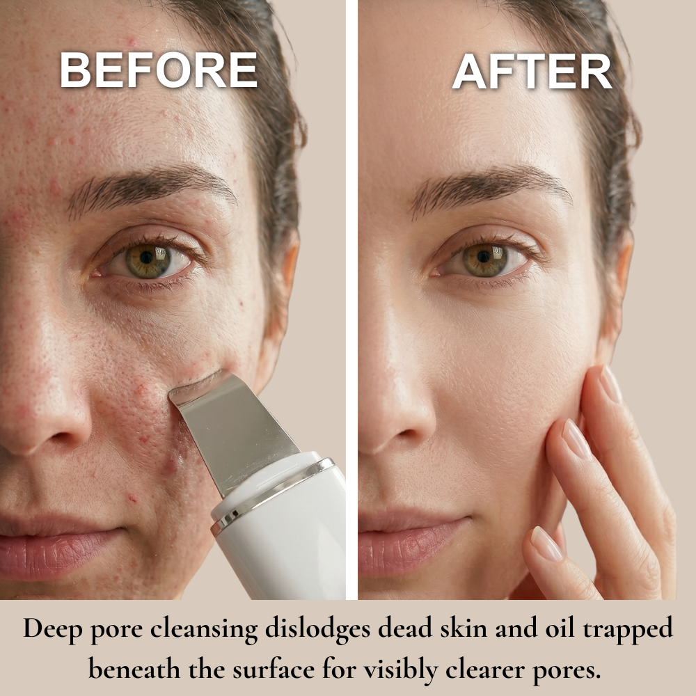 Ultrasonic Skin Scrubber