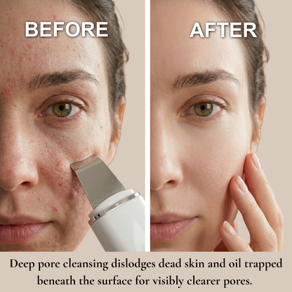 Ultrasonic Skin Scrubber